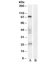 Western blot testing of human brain lysate with Nogo 66 receptor antibody at 0.3ug/ml with [B] and without [A] blocking/immunizing peptide