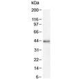 Western blot testing of mouse NIH3T3 cell lysate with CDK9 antibody at 2ug/ml. Predicted molecular weight: ~43 kDa.