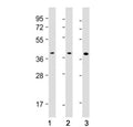 Western blot testing of PU.1 antibody at 1:500: Lane 1) human K562, 2) Daudi and 3) THP1 cell lysate. Predicted molecular weight ~31 kDa but routinely observed at ~40 kDa.