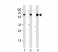 Western blot analysis of lysate from (1) human MCF-7, (2) rat PC-12, and (3) mouse C2C12 cell line using c-Src antibody at 1:1000.