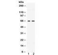 Western blot testing of 1) rat testis and 2) human MCF7 lysate with CCDC6 antibody at 0.5ug/ml. Predicted molecular weight ~53 kDa, routinely observed at ~65 kDa.