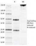 SDS-PAGE Analysis of Purified, BSA-Free CD22 Antibody (clone MYG13). Confirmation of Integrity and Purity of the Antibody.