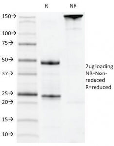 SDS-PAGE Analysis of Purified, BSA-Free CD22 Antibody (clone MYG13). Confirmation of Integrity and Purity of the Antibody.