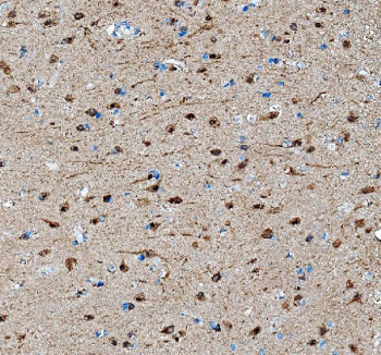 IHC testing of FFPE mouse brain tissue with SAP102 antibody at 1ug/ml. Required HIER: steam section in pH6 citrate buffer for 20 min and allow to cool prior to testing.