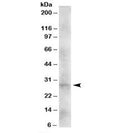 Western blot testing of human heart lysate with DKK2 antibody at 2ug/ml. Expected molecular weight: 28-35 kDa.