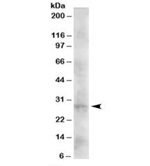Western blot testing of human heart lysate with DKK2 antibody at 2ug/ml. Expected molecular weight: 28-35 kDa.