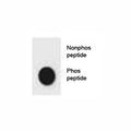 Dot blot analysis of phospho-CDKN2A antibody. 50ng of phos-peptide or nonphos-peptide per dot were spotted.