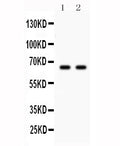 Western blot testing of Parkin antibody and Lane 1: U87; 2: mouse brain lysate. Expected molecular weight: 50-60 kDa with multiple smaller isoforms.