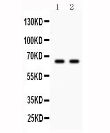 Western blot testing of Parkin antibody and Lane 1: U87; 2: mouse brain lysate. Expected molecular weight: 50-60 kDa with multiple smaller isoforms.