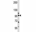 Western blot analysis of NCL and human placenta tissue lysate. Predicted molecular weight is 77 kDa, observed size is 100~110 kDa.