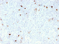 IHC staining of FFPE human tonsil with recombinant IgM antibody (clone rIM260). HIER: boil tissue sections in pH 9 10mM Tris with 1mM EDTA for 10-20 min and allow to cool before testing.