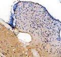 IHC staining of zebrafish Her4 protein using Zebrafish Her4 antibody, HRP-labeled secondary and DAB substrate. Her4 was detected in a paraffin-embedded section of zebrafish brain tissue. HIER: boil tissue sections in pH8 EDTA for 20 min and allow to cool before testing.