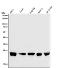 Western blot testing of human samples using the RALA antibody at 1:5000 dilution for 1 hour at room temperature. Predicted molecular weight ~24 kDa.