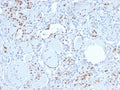 IHC staining of FFPE human kidney with recombinant PAX8 antibody. HIER: boil tissue sections in pH 9 10mM Tris with 1mM EDTA for 20 min and allow to cool before testing.