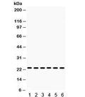 Western blot testing of 1) mouse liver, 2) mouse kidney, 3) mouse testis, 4) human 22RV1, 5) human MCF7 and 6) mouse NIH3T3 lysate with HMG4 antibody. Expected/observed molecular weight ~23 kDa.