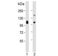 Western blot testing of human 1) lung and 2) liver lysate with VAP-1 antibody. Predicted molecular weight ~85 kDa but may be observed at higher molecular weights due to glycosylation.