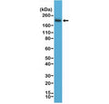 Western blot testing of human Jurkat cell lysate using recombinant CD45 antibody at a 1:2000 dilution. Expected molecular weight: 147-220 kDa depending on glycosylation level.