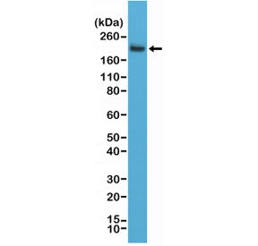 Western blot testing of human Jurkat cell lysate using recombinant CD45 antibody at a 1:2000 dilution. Expected molecular weight: 147-220 kDa depending on glycosylation level.