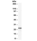 Western blot testing of human testis lysate with Ribosomal Protein L19 antibody at 0.1ug/ml. Expected molecular weight: 23-28 kDa.