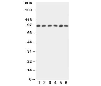 Western blot testing of STAT5b antibody and Lane 1: rat intestine; 2: rat kidney; and human samples 3: HeLa; 4: A549; 5: MM231; 6: COLO320 cell lysate. Predicted molecular weight ~90 kDa.