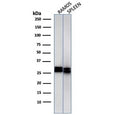 Western blot Anaysis of human 1) Ramos and 2) spleen cell Lyste using HLA-DRB1 antibody (clone HLA-DRB/1067). Predicted molecular weight ~30 kDa.