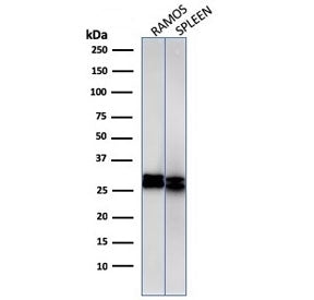 Western blot Anaysis of human 1) Ramos and 2) spleen cell Lyste using HLA-DRB1 antibody (clone HLA-DRB/1067). Predicted molecular weight ~30 kDa.