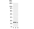 Western blot testing of IL7 antibody and Lane 1: Recombinant human IL-7 protein 10ng; 2: 5ng; 3: 2.5ng
