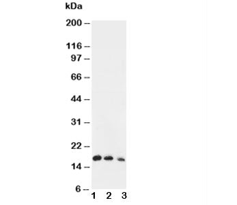 Western blot testing of IL7 antibody and Lane 1: Recombinant human IL-7 protein 10ng; 2: 5ng; 3: 2.5ng