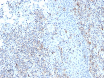 IHC staining of FFPE human tonsil with recombinant CD50 antibody (clone rICAM3/1019). HIER: boil tissue sections in pH 9 10mM Tris with 1mM EDTA for 20 min and allow to cool before testing.