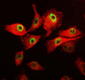 Immunofluorescent staining of FFPE human A549 cells with CDK12 antibody (green) and Beta Tubulin mAb (red). HIER: steam section in pH6 citrate buffer for 20 min.