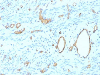IHC staining of FFPE human uterus tissue with recombinant CD34 antibody (clone rHPCA1/8500). HIER: boil tissue sections in pH 9 10mM Tris with 1mM EDTA for 20 min and allow to cool before testing.