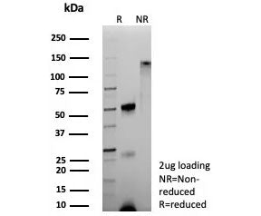 SDS-PAGE analysis of purified, BSA-free recombinant Hemoglobin alpha antibody (clone HBA/9193R) as confirmation of integrity and purity.