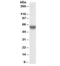 Western blot testing of A431 lysate with TOM1L2 antibody at 0.03ug/ml. Predicted molecular weight: ~50/56kDa (isoforms 1/3).