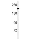 Western blot analysis of A2ML1 antibody and mouse lung tissue lysate. Predicted molecular weight ~161 kDa.