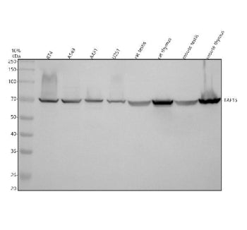 Western blot analysis of TAF15 using anti-TAF15 antibody. Electrophoresis was performed on a 10% SDS-PAGE gel at 80V (Stacking gel) / 120V (Resolving gel) for 2 hours. Lane 1: human RT4 whole cell lysates, Lane 2: human whole cell lysates, Lane 3: human whole cell lysates, Lane 4: human U251 whole cell lysates, Lane 5: rat testis tissue lysates, Lane 6: rat thymus tissue lysates, Lane 7: mouse testis tissue lysates, Lane 8: mouse thymus tissue lysates.