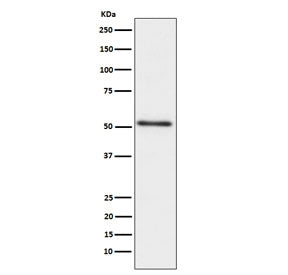 Western blot testing of human prostate cancer lysate with ACPP antibody. Expected molecular weight: 45-50 kDa.