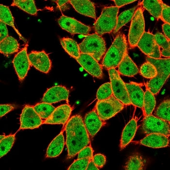 Immunofluorescent staining of PFA-fixed human HeLa cells using MLX antibody (green, clone PCRP-MLX-1G8) and phalloidin (red).