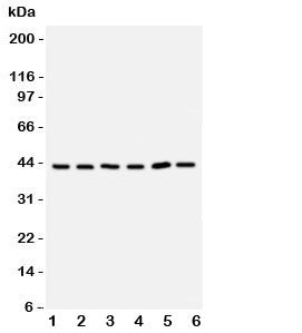 Western blot testing of TRAM antbody; Lane 1: rat brain; 2: (r) kidney; 3: human 293T; 4: (h) Raji; 5: (h) Jurkat cell lysate. Predicted molecular weight ~43 kDa but may be observed at higher molecular weights due to glycosylation.