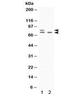 Western blot testing of 1) rat ovary and 2) human SKOV lysate with PLZF antibody. Predicted molecular weight: 74-81 kDa.