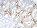 IHC staining of FFPE human kidney tissue with NDPK-B antibody (clone NME2/6436). Inset: PBS used in place of primary Ab (secondary Ab negative control). HIER: boil tissue sections in pH 9 10mM Tris with 1mM EDTA for 20 min and allow to cool before testing.