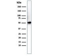 Western blot testing of His-tagged protein with Histidine antibody.