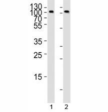 Western blot analysis of lysate from 1) Raji and 2) Ramos cell line using anti-CD19 antibody at 1:1000. It is a glycoprotein visualized between 60~100 kDa.