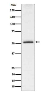 Western blot analysis of Phospho-Tau (S198) expression in mouse hippocampus cell lysate. The expected molecular weight of phosphorylated Tau (Ser198) is approximately 45-70 kDa, corresponding to the major Tau isoforms, and lower molecular weight bands around ~35 kDa may represent truncated Tau fragments commonly observed in brain tissue.
