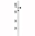 Western blot analysis of GARP antibody and CEM lysate.