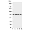 Western blot testing of PGE Receptor antibody and Lane 1: HeLa; 2: A549; 3: MCF-7; 4: MM231; 5: MM453 cell lysate
