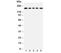 Western blot testing of MUC1 antibody and Lane 1: COLO320; 2: SW620; 3: HEPG2; 4: MCF-7; 5: Jurkat lysate; This glycoprotein is commonly visualized between 120~500 kDa.