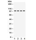 Western blot testing of 1) rat brain, 2) rat skeletal muscle, 3) human PANC and 4) mouse NIH3T3 lysate with MAPK6 antibody. Predicted molecular weight ~83 kDa but routinely observed at ~97 kDa.