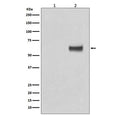 Western blot testing of human MCF7 cells 1) untreated and 2) treated with b-Estradiol and EGF, with phospho-ER alpha antibody. Predicted molecular weight ~66 kDa.