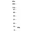 Western blot testing of human HeLa cell lysate with recombinant S100A4 antibody (clone PS1A4-1R). Predicted molecular weight ~12 kDa.