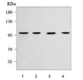 Western blot testing of human 1) HepG2, 2) RT4, 3) PC-3 and 4) A549 cell lysate with WFS1 antibody. Predicted molecular weight ~100 kDa.